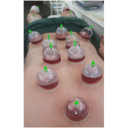 ЦЕНТАР ЗА ХИПНОЗА, МИОФАЦИЈАЛНА ВЕНДУЗИ ТЕРАПИЈА СО МАСАЖА, ХИЏАМА