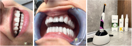 ДЕНТАЛ и АЕСТЕТИК СПОТ